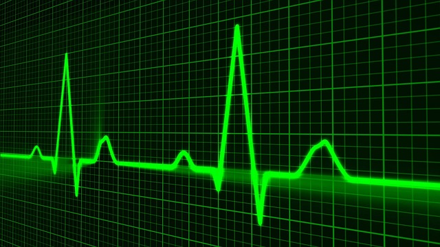 pulse-trace-163708_640.jpg pulse-trace-163708_640.jpg
